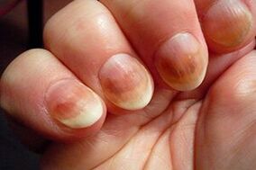 nail mushroom