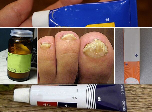 General principles for the treatment of fungi