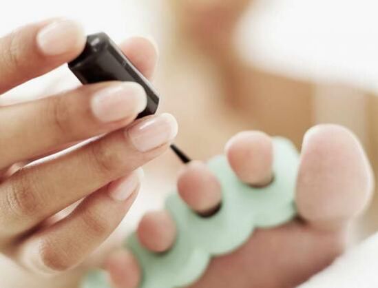 treating nails with nail polish for fungal infection