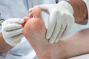 the doctor examines the feet for fungus on the toes