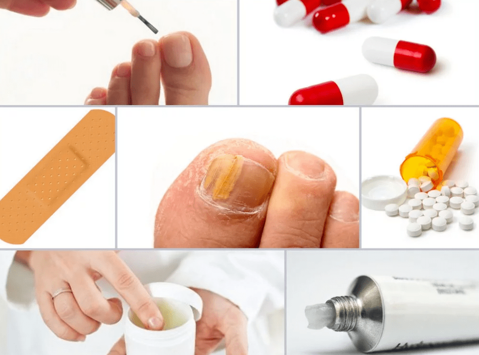 systemic drugs for nail fungus